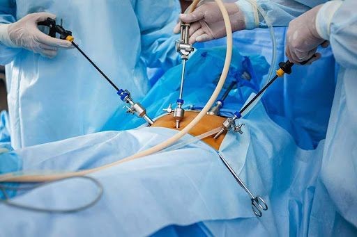 Emergency Laparoscopy